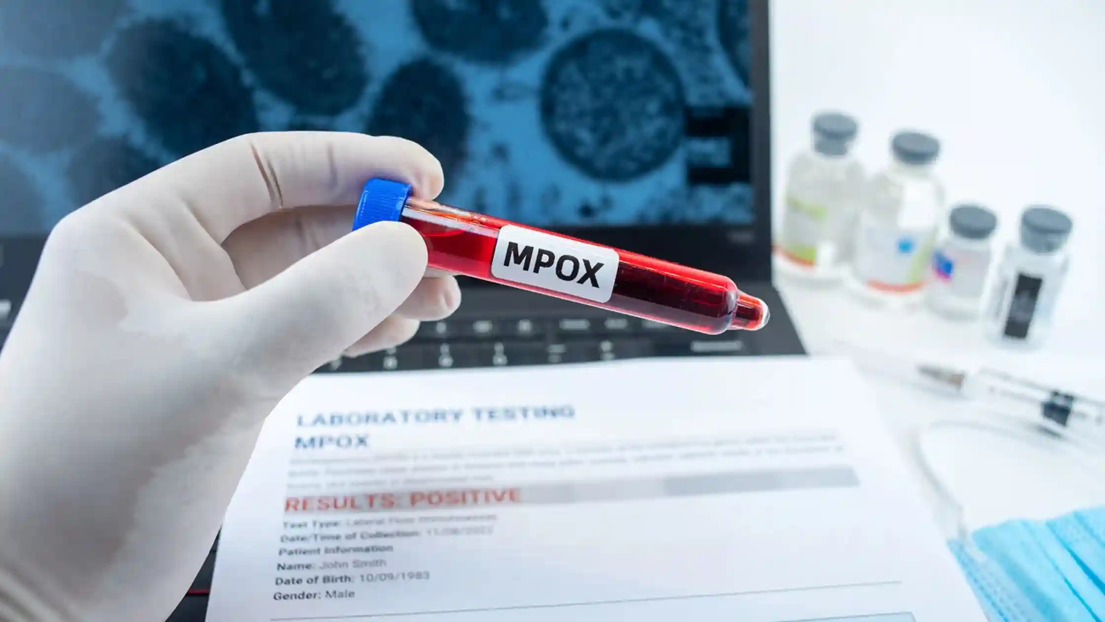 New Mpox Strain Detected in the U.S.